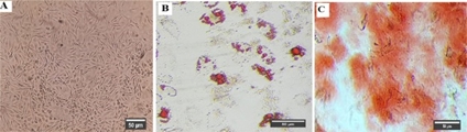 The effects of 17 Beta-Estradiol primed mesenchymal stem cells on the biology of co-cultured neutrophil