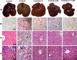 Chlorella vulgaris and Lactobacillus casei Improve Liver Dysfunction via UPR and Autophagy in High-Fat Diet-Induced NAFLD in Mice